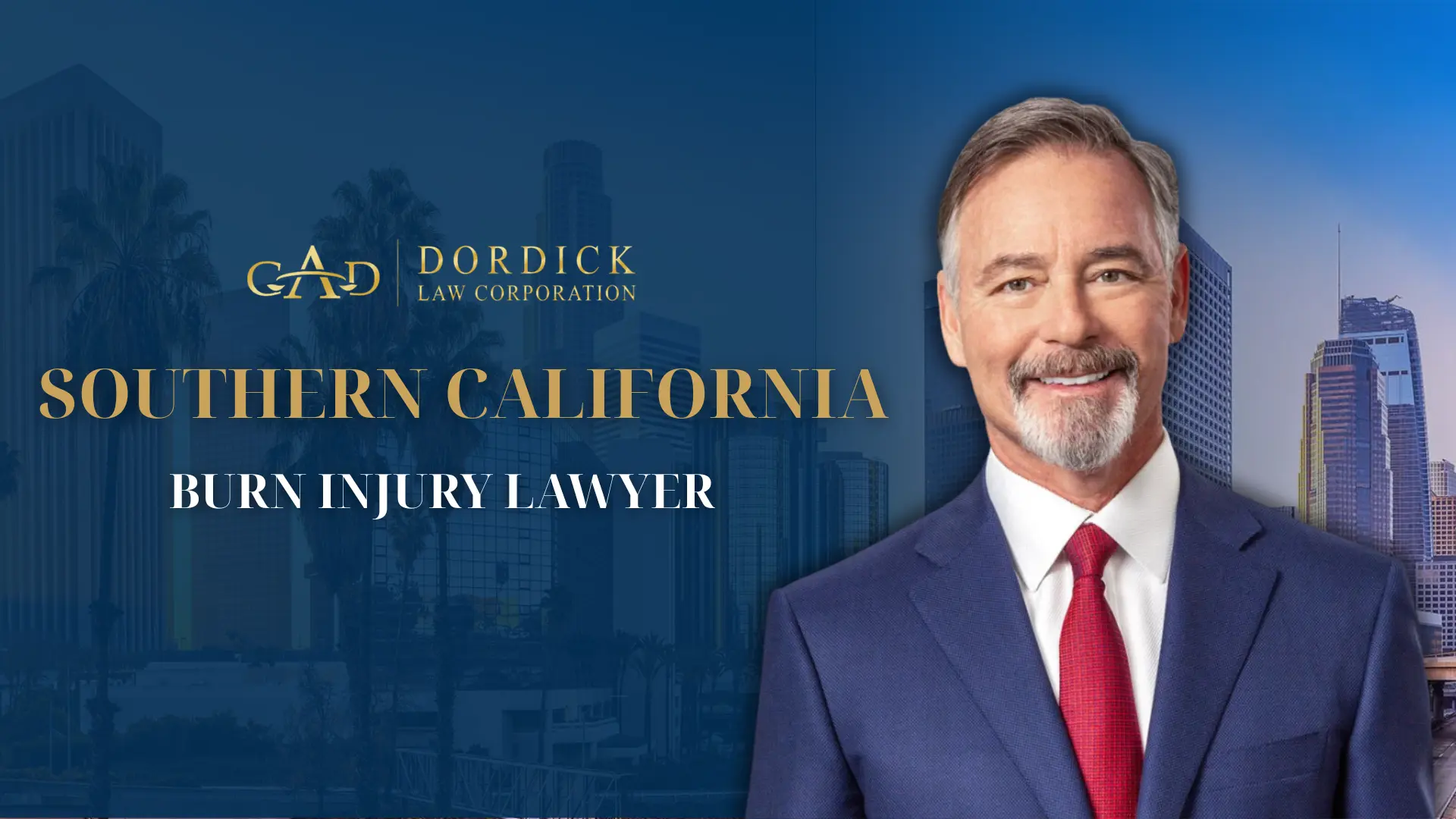 Southern California Burn Injury Lawyer Image